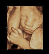 3D-einBlick.de Ultraschallstudio