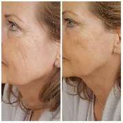 Amway und Dr. Juchheim-Methode Produkte und Vertriebsmöglichkeit - 30