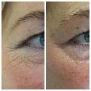 Amway und Dr. Juchheim-Methode Produkte und Vertriebsmöglichkeit - 37