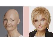 Apollo Hair Center - GALLERY