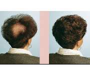 Apollo Hair Center - GALLERY