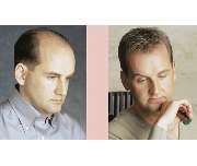 Apollo Hair Center - GALLERY