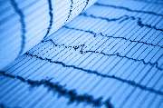 Arzt | Dr. Gordan Lasic | München - EKG | Dr. Gordan Lasic | München