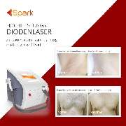 Beauty Solutions - Dauerhafte Haarentfernung in Ludwigshafen - GALLERY