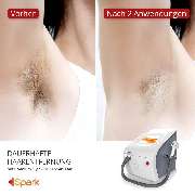 Beauty Solutions - Dauerhafte Haarentfernung in Ludwigshafen - GALLERY