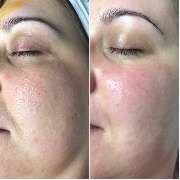 BeautyLounge - GALLERY