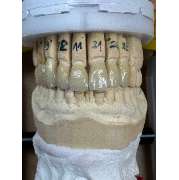 confidenta Dentallabor - GALLERY