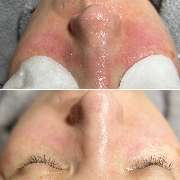 Contura Cosmetics - GALLERY