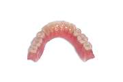 Dental-Labor Hans Fuhr GmbH & Co. KG Köln - ECLIPSE
DIE BIOKOMPATIBLE LÖSUNG FÜR IHRE ALLERGIEPATIENTEN