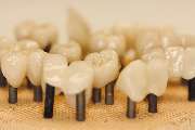 Dental-Labor Hans Fuhr GmbH & Co. KG Köln - EMPRESS/IPS E.MAX