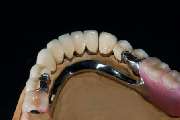 Dental-Labor Trivident - GALLERY