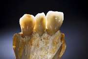 Dental-Labor Trivident - GALLERY