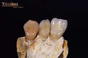 Dental-Labor Trivident - GALLERY