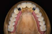 Dental-Labor Trivident - GALLERY