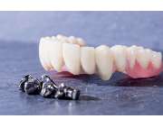 Dental-Labor Zöllner, Rohde & Co. GmbH - GALLERY