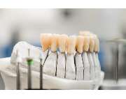 Dental-Labor Zöllner, Rohde & Co. GmbH - GALLERY