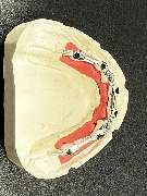 Dentallabor Achim Carnott Köln - Dentallabor Achim Carnott