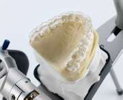 Dentallabor Christian Stroehl - GALLERY