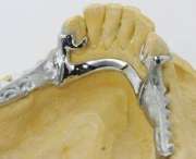 Dentallabor Christian Stroehl - GALLERY