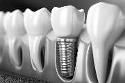 Dentallabor Grüttner GmbH - GALLERY