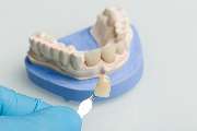 Dentallabor Gunzelmann - GALLERY