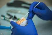 Dentallabor Gunzelmann - GALLERY