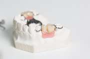 Dentallabor Gunzelmann - GALLERY