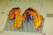 Dentallabor Hallweger GmbH & Co. KG - GALLERY