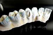 Dentallabor Hallweger GmbH & Co. KG - GALLERY