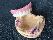 Dentaltechnik Oriwal - GALLERY