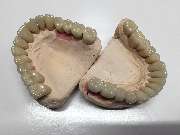 Dentaltechnik Oriwal - GALLERY