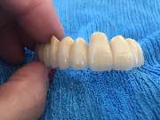 Dentaltechnik Oriwal - GALLERY