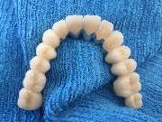 Dentaltechnik Oriwal - GALLERY