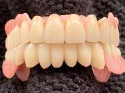 Dentaltechnik Oriwal - GALLERY