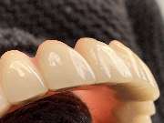 Dentaltechnik Oriwal - GALLERY