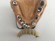 Dentaltechnik Oriwal - GALLERY