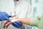 Dermatologikum Bremen - Ein Arzt in weißem Kittel und blauen Handschuhen führt mit einem modernen Auflichtmikroskop eine Hautuntersuchung am Unterarm einer Patient:in durch. Die Szene zeigt einfühlsame, professionelle dermatologische Diagnostik.