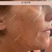 Diana Birke - Praxis für Kosmetik - GALLERY