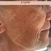 Diana Birke - Praxis für Kosmetik - GALLERY