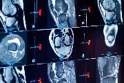 Dr. Lins | Ihre MRT Radiologie Privatpraxis Stuttgart | Schnelle Termine Vorsorge und mehr - GALLERY
