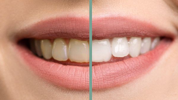 Dr. med. dent. Nina Moll - GALLERY