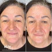 Enjoy Cosmetics | Kosmetikstudio Heilbronn | Hautpflege und Gesichtsbehandlungen in Leingarten - GALLERY
