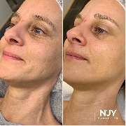 Enjoy Cosmetics | Kosmetikstudio Heilbronn | Hautpflege und Gesichtsbehandlungen in Leingarten - GALLERY