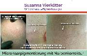 GI-MHP Ultra Nano Haarpigmentierung - Microhaar Pigmentierung 061