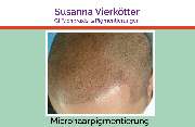 GI-MHP Ultra Nano Haarpigmentierung - Microhaar Pigmentierung 068