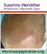 GI-MHP Ultra Nano Haarpigmentierung - Microhaar Pigmentierung 068-