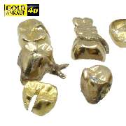 Zahngold verkaufen Köln
