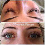 Haarfrei | beauty by GE - 6