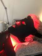 Hautzart Frankfurt – Hautverjüngung & Ästhetische Medizin - GALLERY