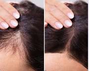 Health & Aesthetics Permanent Make Up/ Haarpigmentierung und Zahnbleaching - GALLERY